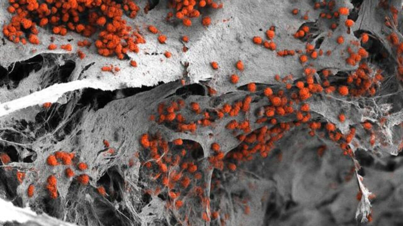 مدل آزمایشگاهی مغز استخوان انسان